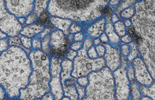 Slice by Slice Thinning
